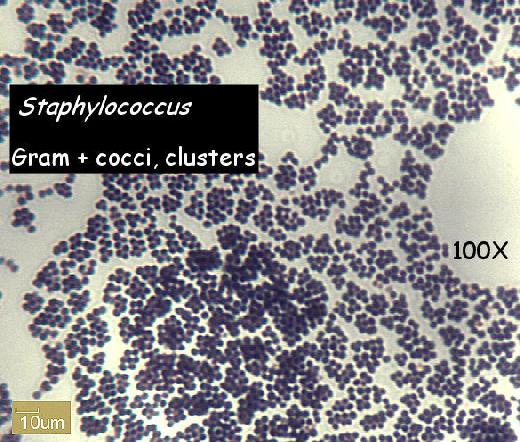 DNase agar plate Novobiocin (5 microgram) antibiotic disks Metric rulers Rabbit plasma (frozen) for coagulase test Staphylococcus identification tables SCHEMATIC OF IDENTIFICATION PROCEDURE 1st