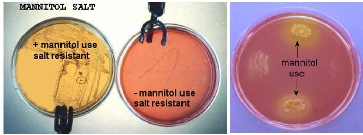 Another characteristic you should look for is any colony around which the medium has turned yellow (identifying the fermenters of mannitol, of which some species of Staph are).