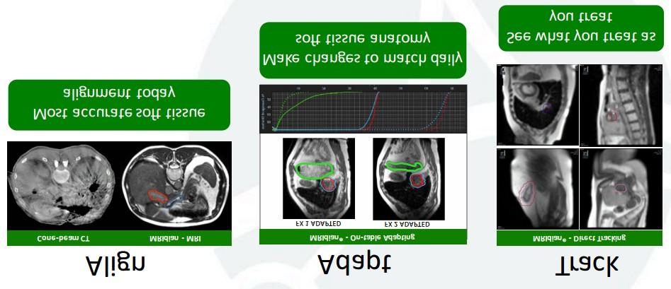 APPLICATIONS (Source: www.viewray.com) IMRT is an advanced form of EBRT in which the shape, angle and intensity of the radiation beam are varied for precise, targeted therapy.