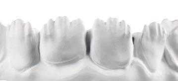 The result is absolutely low-vibration processing, which in combination with Ceramill control technology produces impressive precision on the blank.