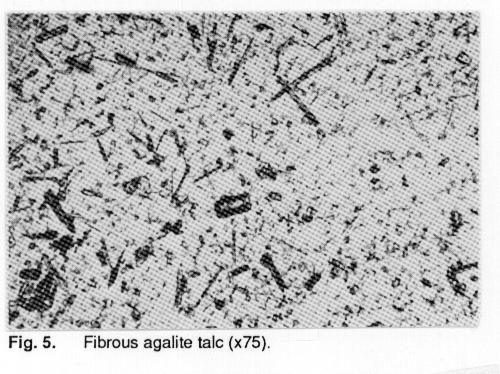 Thus positive identification by observation of particle shape and so forth is only available through electron microscopy. 16.1.5 Figure 5 gives a low magnification view of agalite talc, i.e., a fibrous form of talc, which is now restricted for use in food board (paper) by the FDA.