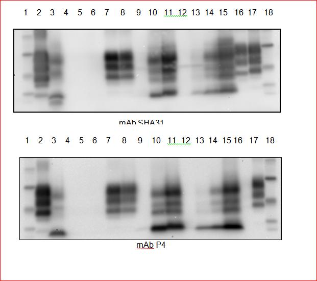 Figure 2: Results of the Western Blot performed