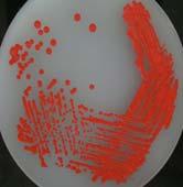 Five I s: Isolate Three basic methods of isolating bacteria Streak Plate Isolate: Streak Plate This method
