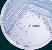 type of bacteria to grow by the