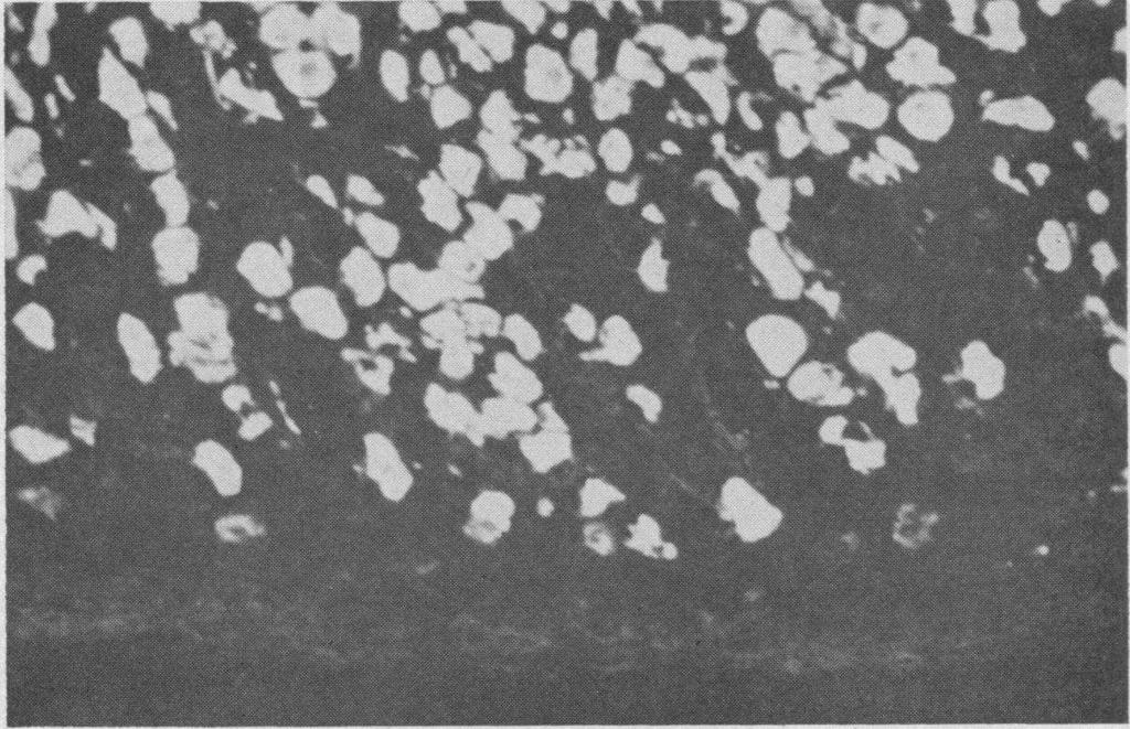 222 GRAHAM H. JEFFRIES AND MARVIN H. SLEISENGER routine light microscopic examination. For immunofluorescent studies, the gastric biopsy specimens were immediately embedded in 7.