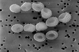 Particles Micro-organisms Allergens