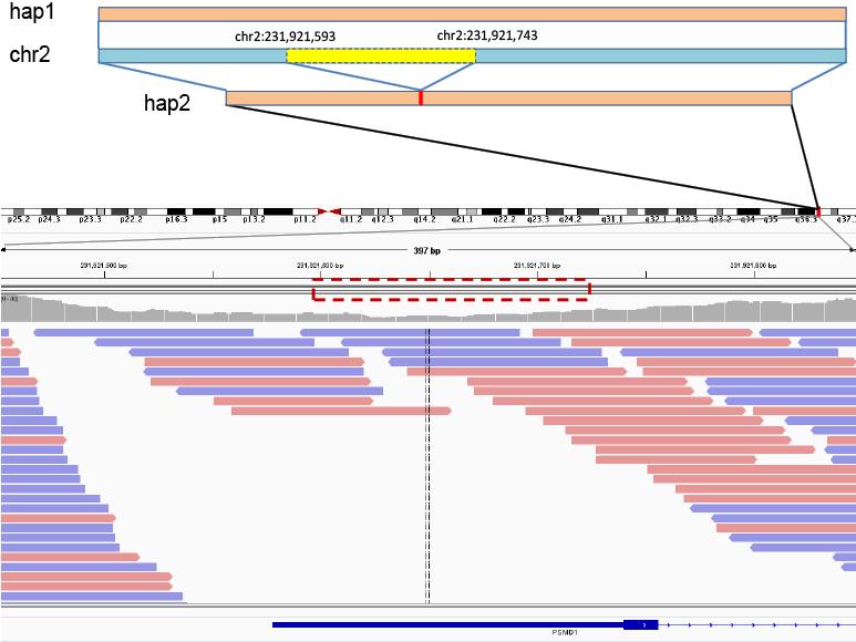 Supplementary Figure 11 Example of a heterozygous deletion located inside a gene. This heterozygous deletion was detected by the ASV method but difficult to find by either WGS resequencing method.