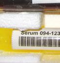 tube Serum sample tube (1 ml of serum) Red-top tube Fecal sample