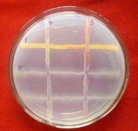 Compatibility between fungal antagonists FIGURE 2: Compatibility between bacterial antagonists Compatibility between actinomycetes isolates Two actinomycetes, ORA-1 and VRA-1 were found compatible,