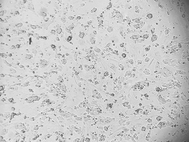 ES cell Fetal Bovine Serum Applied Stem Cell, ATCC, Millipore, Invitrogen Glutamax B-mercaptoethanol, Sigma Non-essential amino acids, Sodium pyruvate, Leukemia Inhibitory Factor Millipore, Stem Cell