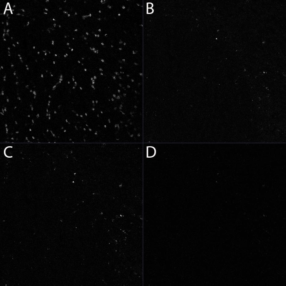 How to perform-control immunostaining experiment - microscopist subjective point of view.