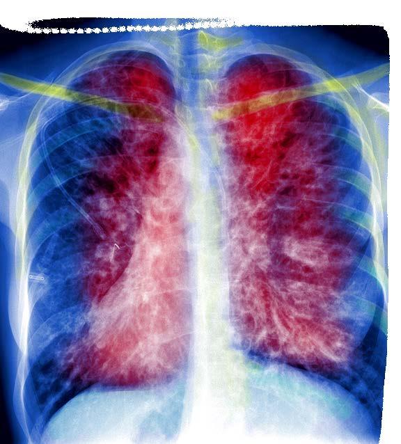 Respiratory Heritage: 115 Years of Respiratory