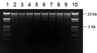 Examples of Expected Results Blood gdna Miniprep Genomic DNA from various samples was isolated using a JetQuick Blood & Cell Culture DNA Miniprep Kit and analyzed by agarose gel electrophoresis on a