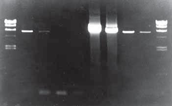 Lanes 1-4 contain PCR products obtained using 1 ng of λ DNA template amplified using TaKaRa Taq DNA Polymerase with various primer sets. PCR products were analyzed by agarose gel electrophoresis.