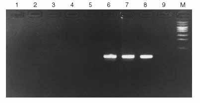 Routine PCR Determination of Polymerase Bacterial DNA Contamination TaKaRa Taq is confirmed to be a low DNA contamination grade enzyme. Because typically Taq DNA polymerase is cloned in E.