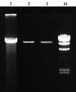 High Performance PCR Application: High Performance PCR Amplification of a 21.5 kb Human Genomic DNA Fragment using TaKaRa LA Taq. The efficiency of TaKaRa LA Taq in amplification of a 21.