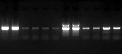 Hot Start PCR Application: Hot Start PCR Comparison of TaKaRa Ex Taq Hot Start version Four Competing Hot Start Enzymes in Amplification of a 1.1 kb Bacillus sp. genomic DNA target.