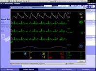 EKG Reports EKG Data