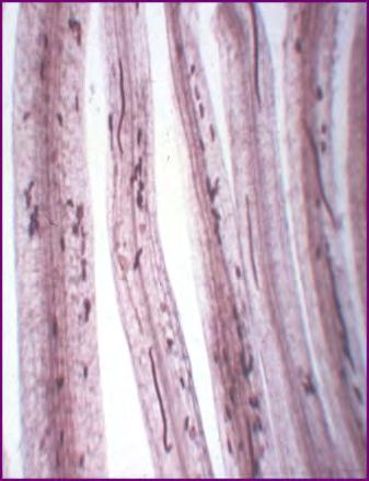 Root Lesion Nematode: Root-lesion nematodes feed as migratory endoparasites in root tissue. They stunt plant growth and result in low yields. More than 70 species have been described.
