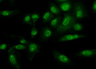experiments drag the molecule in different specific sub-cellular locations and functional activity of the