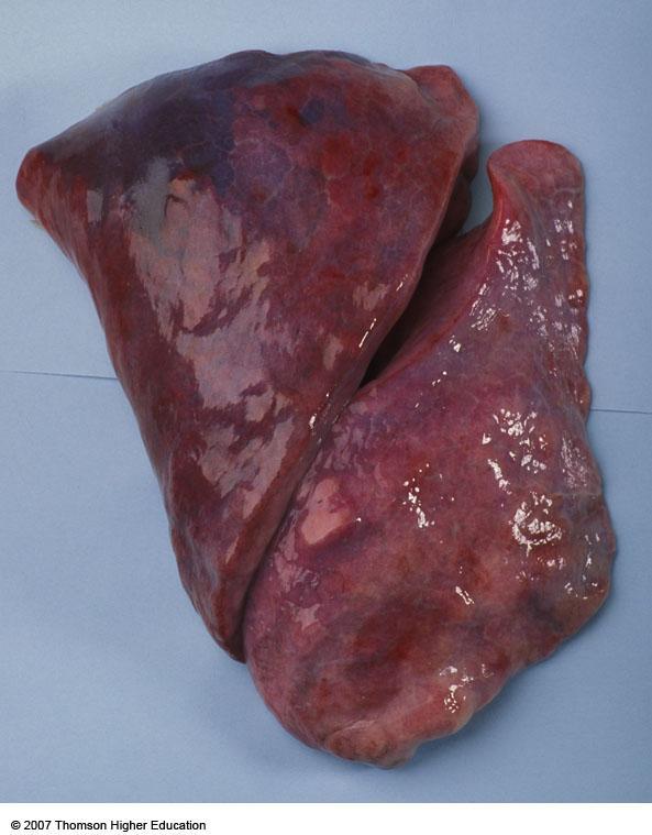 Normal human lungs