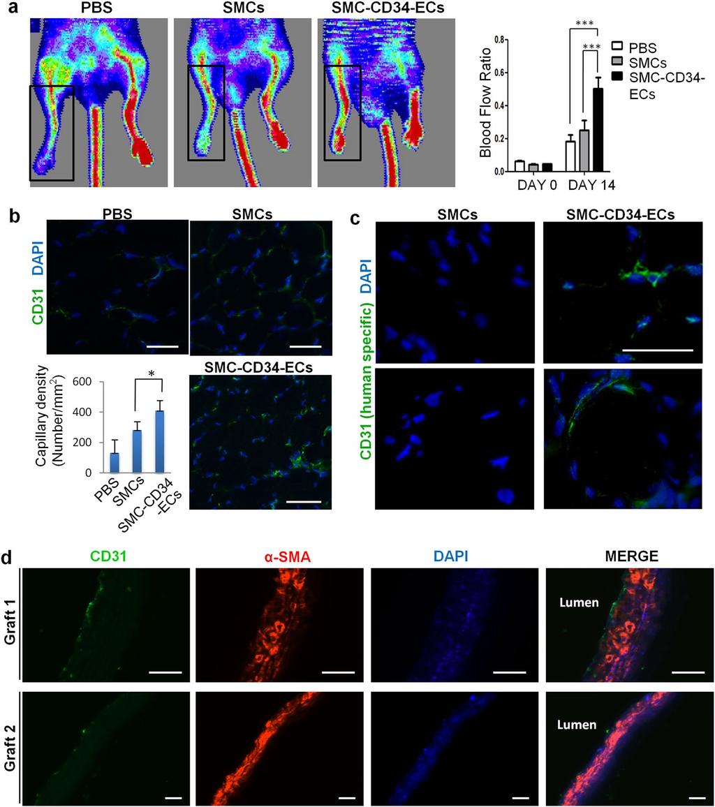Figure 4. Therapeutic angiogenesis capacity of SMC-derived ECs in the mouse hindlimb ischemic model and the construction of tissue-engineering vascular grafts with SMC-CD34-ECs.
