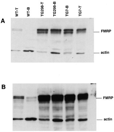 1148 Human Molecular Genetics, 2000, Vol. 9, No. 8 Figure 3. Quantification of FMRP levels in FMR1 YAC transgenic mice.