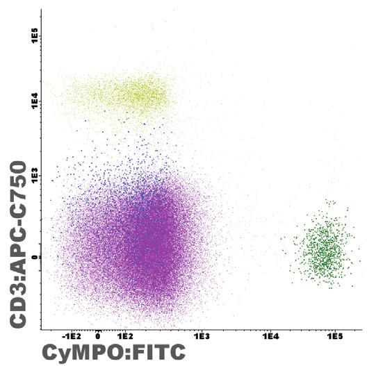 5 PE-Cyanine7 APC APC-C750 CyCD3 CD45 CyMPO CyCD79a - CD19 CD7 SmCD3 Pathological bone marrow sample stained with ALOT-7 kit.
