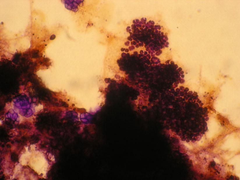 Microbiological Observations Neisser staining was used to investigate both PAO and tetrad-forming GAO under the microscope.