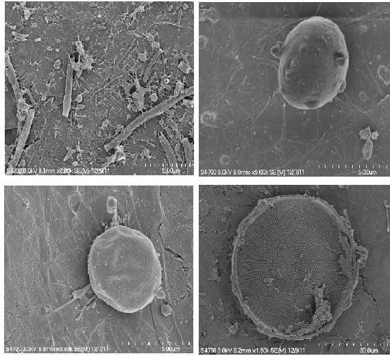 more detailed study on the different types of bacteria, fungi, and other microorganisms present in MFCs powered by wastewater sludge, as the range is obviously very broad. Figure 4.