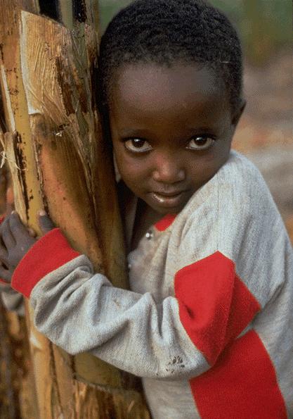 Malnutrition and Hidden Hunger in Africa Acute Malnutrition: 2 25 % Stunting (children < 5 years): 10 - > 50% Anemia, Iron: < 5yrs 40%, pregnant women 80%, 40%