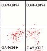Two cases were called suspicious for the presence of a clonal plasma cell population using 4-color analysis but were interpreted as positive using 6-color analysis Image 2, as a result of an abnormal