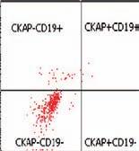Monotypic immunoglobulin λ light chain expression was seen in the 6-color analysis but was not detected using
