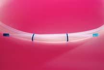 tubing without effecting mechanical properties Canbedone over the length of the tube or for specific lengths on the end Extrusions can be etched on the ID, OD or tip Additional details available in