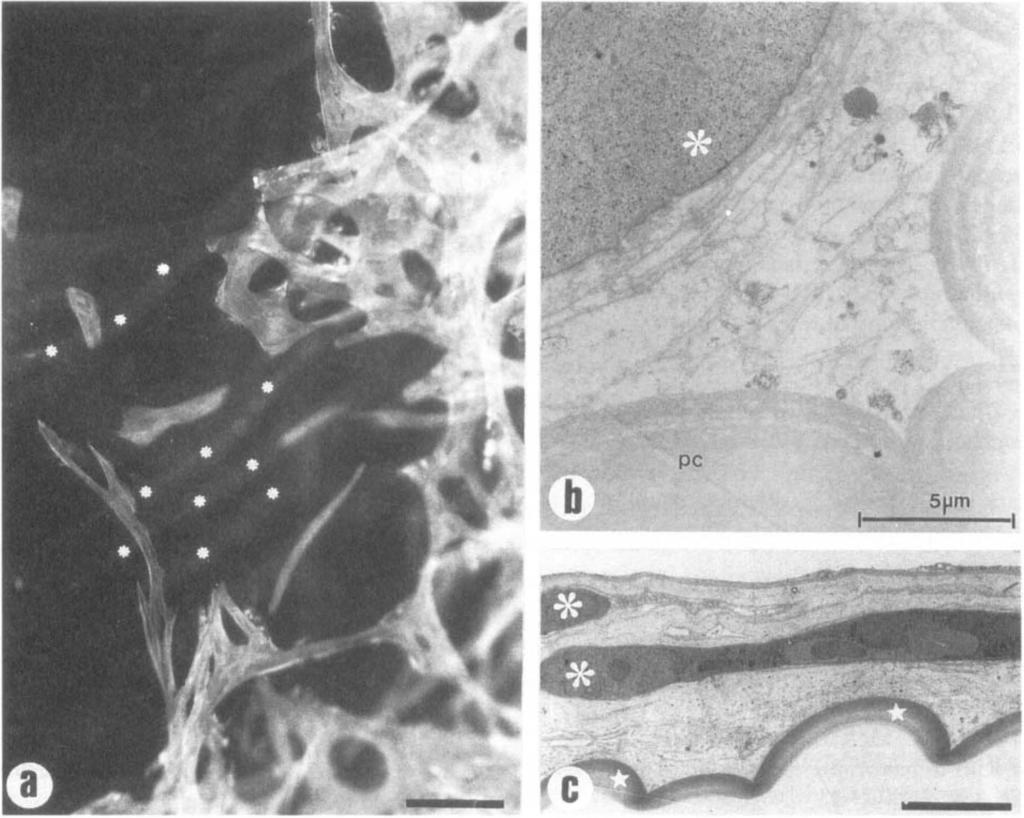 Fig. 4. (a) Epifluorescence micrograph of multilayers of a-sma positive cells on the posterior capsule, overlying wrinkles (small asterisks) which are free of cells. Scale bar represents 100 JLm.