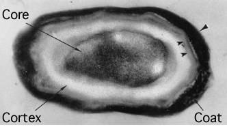 Endospores Bacteria develop tough coating Resists heat, drying, UV radiation,