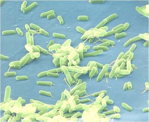 Bacteria Smallest living organisms 250,000 500,000 fit inside.