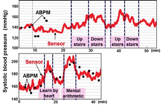 Therefore, the prototype of a wearable blood pressure sensor has been built (Fig. 4), which is composed of ECG sensor and pulse wave sensor at a 1-kHz sampling rate.