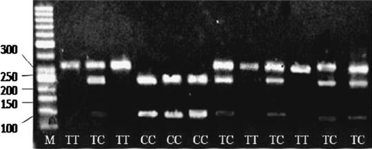 For CACNA2D1(2), the following genotypes were differentiated: AA (386 bp), AG (386 bp, 229 bp and 157 bp), and GG (229 bp and 157 bp). Results for CACNA2D1(1) and CACNA2D1(2) are shown in Figs.