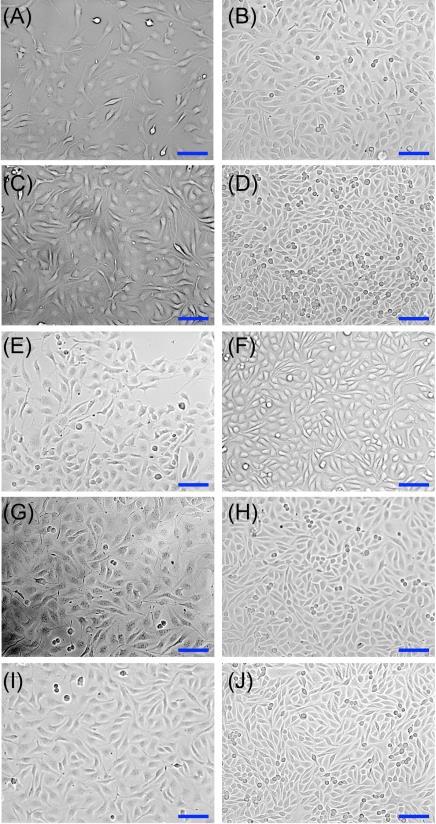 Figure S5. Photomicrographs of L929 cells on (A, B) P5G0.01, (C, D) P5G0.1, (E, F) P2.5G0.1, (G, H) P10G0.