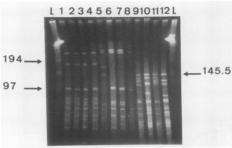 gannii lambda DNA concatemers (lanes L) and DNAs fron n isolates N34 isolates were obtained, and among them, 7 isolates exhibited (lane ), PBi (lane ), G5 (lane 3), VS468 (lane 4), VtS86 (lane 5) the