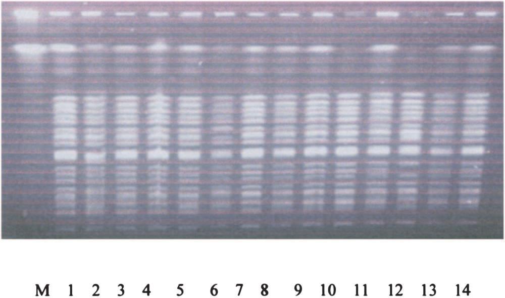 CTX-M-15 and OXA-30 β-lactamase-producing E. coli 299 60 sec at a voltage of 200 V for 20 hr at 14 C. A bacteriophage λ-dna ladder (Bio-Rad) was used as the DNA molecular weight marker.