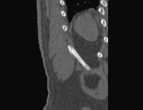 What s more, the combination of SPECT and CT increases diagnostic specificity, for example, in bone