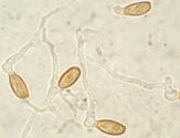 Basidiospores Spores transmit by air & vector (insects) MPOB (2003) - 10 out of 13 species of