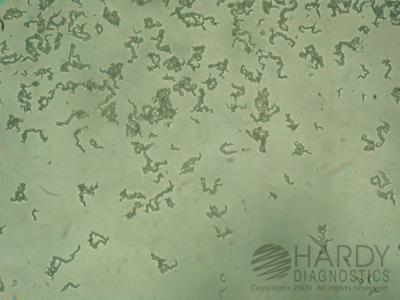 Image 1: Mycobacterium tuberculosis (clinical isolate) Image 2: Mycobacterium tuberculosis (clinical