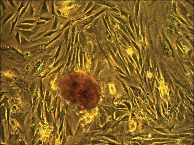 Figure 5 - Placental cells harvested from the hollow fiber bioreactor and placed in a T-75 flask.