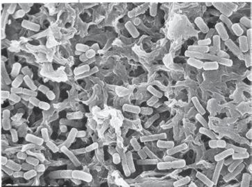 Figure 10. SEM of common beer spoilage organisms, Lactobacillus brevis trapped on the surface of LifeASSURE BA series membrane.