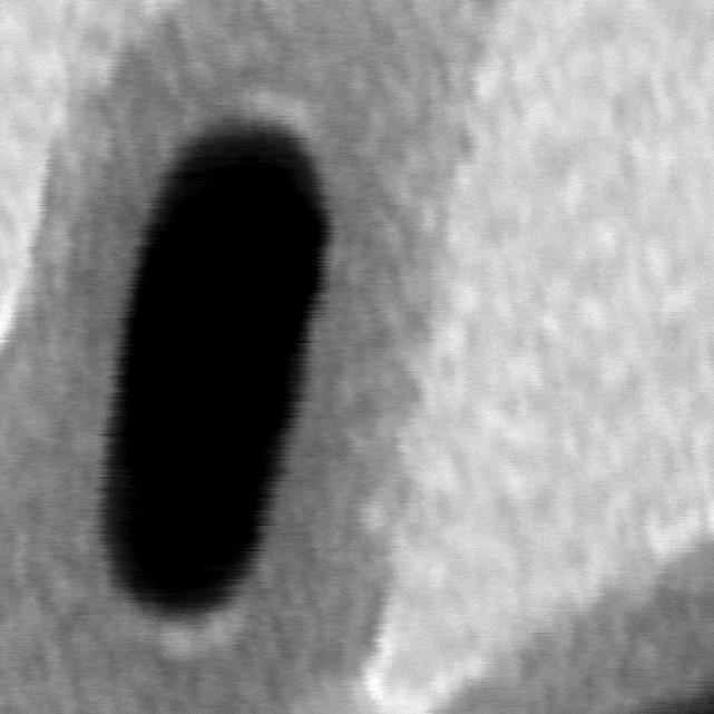 pulses of 20 mj/cm 2 laser light; the yellow circles indicate the nanorods which have hollow