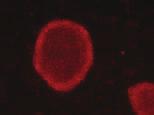 cells at passage 2 recovered from freezing condition in CryoStem freezing medium. Cells were maintained on feeder layer. Cell colony exhibits a distinct morphology typical of pluripotent hescs.