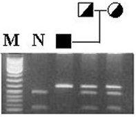 Molecular Identification: Prenatal Diagnosis Chorionic Villus Amniotic Fluid 644